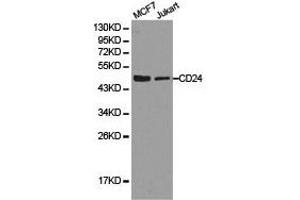 Western Blotting (WB) image for anti-CD24 Molecule (CD24) antibody (ABIN1871597) (CD24 抗体)
