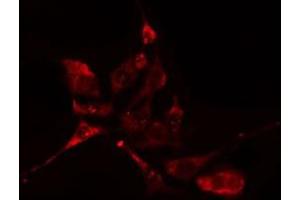 ABIN6276612 staining HuvEc cells by IF/ICC. (CA3 抗体  (N-Term))