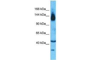 Host:  Rabbit  Target Name:  SLC12A2  Sample Type:  Thymus Tumor lysates  Antibody Dilution:  1. (SLC12A2 抗体  (N-Term))