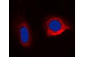 Immunofluorescent analysis of Caspase 6 staining in HepG2 cells. (Caspase 6 抗体  (C-Term))