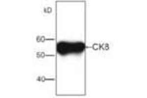Image no. 1 for anti-Keratin 8 (KRT8) antibody (ABIN791532) (KRT8 抗体)