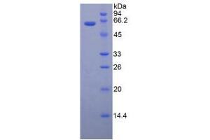 SDS-PAGE analysis of Mouse TERT Protein. (TERT 蛋白)