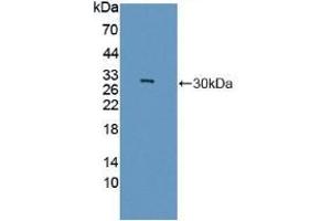 Detection of Recombinant GAMT, Rat using Polyclonal Antibody to Guanidinoacetate-N-Methyltransferase (GAMT) (GAMT 抗体  (AA 2-236))