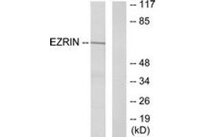 Western Blotting (WB) image for anti-Ezrin (EZR) (AA 321-370) antibody (ABIN2888987) (Ezrin 抗体  (AA 321-370))