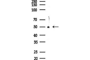 Western blot analysis of lysates from COLO205 cells(heat-shock,45 min treatment), using Osteoprotegerin Antibody at 1/1000 dilution.