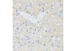 Immunohistochemistry of paraffin-embedded rat liver using SLC3A2 antibody (ABIN1876903) at dilution of 1:100 (40x lens). (SLC3A2 抗体)