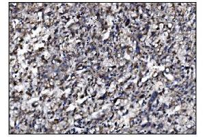 IHC analysis of SLFN11 using anti-SLFN11 antibody (ABIN7599761). (SLFN11 抗体  (AA 114-794))