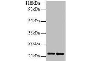 Western blot All lanes: RPS9 antibody at 2 μg/mL Lane 1: 293T whole cell lysate Lane 2: EC109 whole cell lysate Secondary Goat polyclonal to rabbit IgG at 1/15000 dilution Predicted band size: 21 kDa Observed band size: 21 kDa (RPS9 抗体  (AA 2-184))