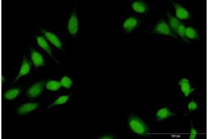 Immunofluorescence of purified MaxPab antibody to RBL1 on HeLa cell. (p107 抗体  (AA 1-1014))