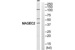 Western blot analysis of extracts from 293 cells, using MAGEC2 antibody. (MAGEC2 抗体  (Internal Region))