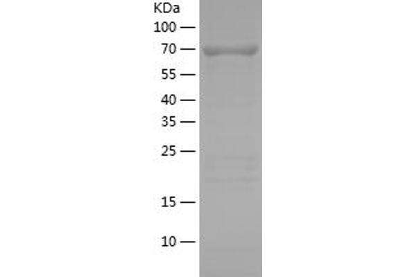 ERK2 Protein (AA 1-360) (His-IF2DI Tag)
