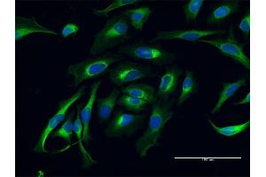 Immunofluorescence of purified MaxPab antibody to LAMB1 on HeLa cell. (Laminin beta 1 抗体  (AA 1-1786))