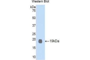Western blot analysis of the recombinant protein. (GDF1 抗体  (AA 230-357))