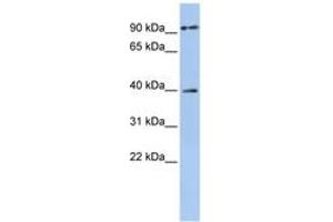 Image no. 1 for anti-Melanoma Antigen Family A, 6 (MAGEA6) (AA 216-265) antibody (ABIN6743406) (MAGEA6 抗体  (AA 216-265))