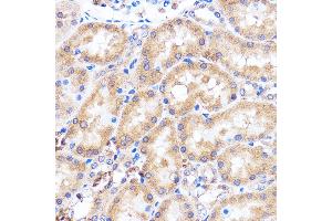Immunohistochemistry of paraffin-embedded Rat kidney using p38 MAPK Rabbit pAb (ABIN7268616) at dilution of 1:100 (40x lens).