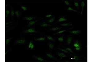 Immunofluorescence of monoclonal antibody to SUB1 on HeLa cell. (SUB1 抗体  (AA 32-124))