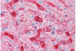 Human Liver (formalin-fixed, paraffin-embedded) stained with B2M antibody ABIN334257 at 5 ug/ml followed by biotinylated anti-mouse IgG secondary antibody ABIN481714, alkaline phosphatase-streptavidin and chromogen. (beta-2 Microglobulin 抗体)