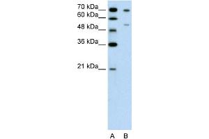 WB Suggested Anti-FOXB2 Antibody Titration:  0. (FOXB2 抗体  (N-Term))