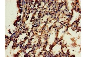 Immunohistochemistry of paraffin-embedded human lung tissue using ABIN7166771 at dilution of 1:100 (RBFA 抗体  (AA 201-343))