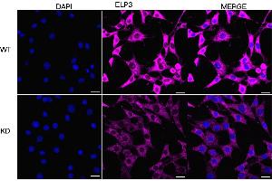 Immunocytochemical staining of HT- cells using ELP3 antibody (ABIN7798434), 1:1,000), Top panel: wild-type (WT), Bottom panal: ELP3 shRNA knockdown (KD). (Recombinant ELP3/KAT9 抗体)