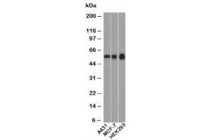 Western blot testing of human samples with p53 antibody (BP53-12).