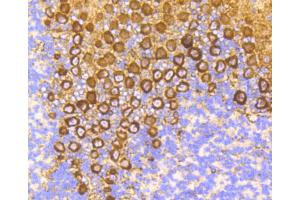 Immunohistochemistry of paraffin-embedded mouse brain using PRKCA antibody (ABIN4904772) at dilution of 1:100 (40x lens). (PKC alpha 抗体)