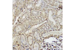 Immunohistochemistry of paraffin-embedded mouse kidney using P Glycoprotein Rabbit pAb (ABIN6134229, ABIN6136340, ABIN6136343 and ABIN6215453) at dilution of 1:250 (40x lens). (ABCB1 抗体  (AA 600-700))