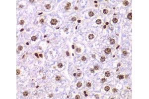 Immunohistochemistry of paraffin-embedded Mouse liver using SSRP1 Polyclonal Antibody at dilution of 1:200 (40x lens). (SSRP1 抗体)