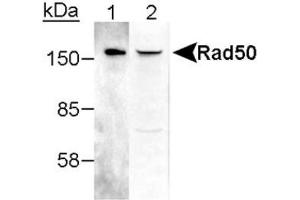 Image no. 2 for anti-RAD50 Homolog (S. Cerevisiae) (RAD50) antibody (ABIN363487) (RAD50 抗体)