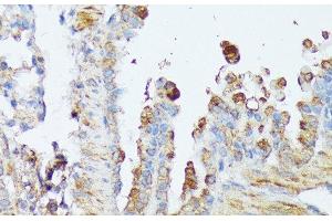 Immunohistochemistry of paraffin-embedded Mouse lung using WNT1 Polyclonal Antibody at dilution of 1:100 (40x lens).