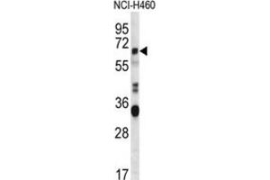 Western Blotting (WB) image for anti-HERV-FRD Provirus Ancestral Env Polyprotein (Herv-frd) antibody (ABIN2997084) (HERV-FRD Provirus Ancestral Env Polyprotein (Herv-frd) 抗体)