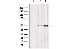 Western blot analysis of extracts from various samples, using NOB1 antibody. (NOB1 抗体  (C-Term))