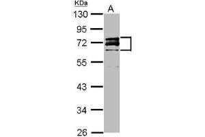 Western Blot: Lamin A/C antibody staining of HeLa Nucleus (A) (20 µg) at 1/3000 dilution, 10% SDS PAGE. (Lamin A/C 抗体  (AA 59-249))