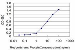 Detection limit for recombinant GST tagged KIAA2002 is approximately 0. (PEAK1 抗体  (AA 1151-1250))