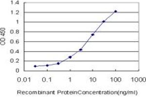 Detection limit for recombinant GST tagged RORB is approximately 0. (RORB 抗体  (AA 136-224))