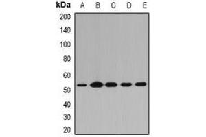 Western blot analysis of PGD expression in A549 (A), Raji (B), mouse lung (C), mouse spleen (D), rat kidney (E) whole cell lysates. (PGD 抗体)