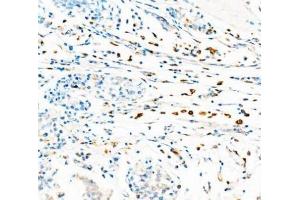 IHC analysis of CD68 using anti-CD68 antibody (ABIN7600142).
