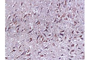 Formalin-fixed and paraffin embedded rat brain tissue labeled with Anti-SYP p38/Synaptophysin/SAP-1 Polyclonal Antibody, Unconjugated (ABIN725285) at 1:200, followed by conjugation to the secondary antibody and DAB staining (SYAP1 抗体  (AA 151-230))