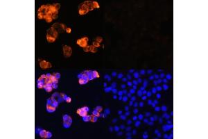 Immunofluorescence analysis of HepG2 cells (upper left) and LO2 cells (negative sample control) (upper right) using Alpha-Fetoprotein (Alpha-Fetoprotein (AFP)) Rabbit pAb (red, ABIN6129175, ABIN6136616, ABIN6136618 and ABIN6215038) at dilution of 1:100. (alpha Fetoprotein 抗体  (AA 360-609))