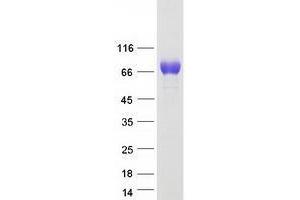 Western Blotting (WB) image for Tyrosinase-Related Protein 1 (TYRP1) protein (Myc-DYKDDDDK Tag) (ABIN2734732)