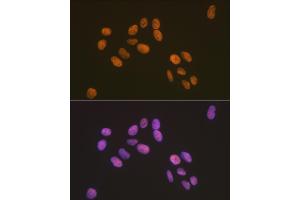 Immunofluorescence analysis of U-2 OS cells using ZBTB7A/FBI-1/LRF Rabbit mAb (ABIN7271439) at dilution of 1:100 (40x lens). (ZBTB7A 抗体)