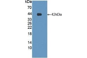 Detection of Recombinant LPHN3, Human using Polyclonal Antibody to Latrophilin 3 (LPHN3) (LPHN3 抗体  (AA 1105-1447))