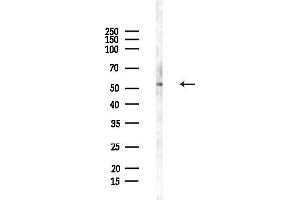 Western blot analysis of lysates from Hela cells(heat-shock,45 min treatment), using CAMKK1 Antibody at 1/1000 dilution.