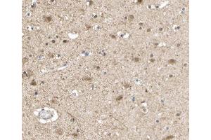 ABIN6266632 at 1/100 staining human brain tissue sections by IHC-P. (S100A1 抗体  (N-Term))
