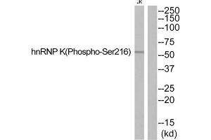 Western blot analysis of extracts from JurKat cells, using hnRNP K (Phospho-Ser216) antibody. (HNRNPK 抗体  (pSer216))