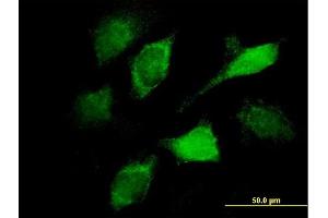 Immunofluorescence of monoclonal antibody to VAV1 on HeLa cell. (VAV1 抗体  (AA 681-790))