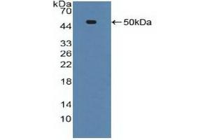 Detection of Recombinant ADRbK1, Human using Polyclonal Antibody to Tumor Necrosis Factor Receptor 1 (TNFR1) (TNFRSF1A 抗体  (AA 60-236))