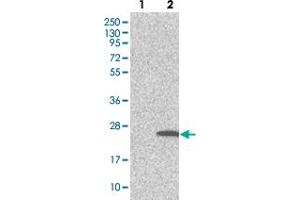 Western blot analysis of Lane 1: Negative control (vector only transfected HEK293T lysate). (TMEM159 抗体)