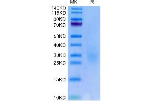 Biotinylated Human NKG2C&CD94 on Tris-Bis PAGE under reduced condition.