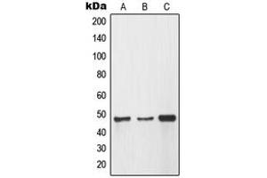 Western blot analysis of MMP12 expression in A549 (A), HEK293 (B), HeLa (C) whole cell lysates. (MMP12 抗体  (Center))
